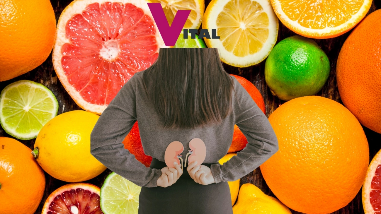 Kollagen und Nierensteine